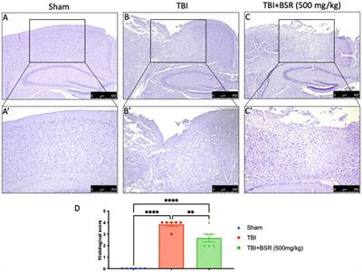 Autophagy machinery plays an essential role in traumatic brain injury-induced apoptosis and its related behavioral abnormalities in mice: focus on Boswellia Sacra gum resin
